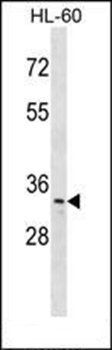 TP53RK antibody