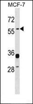 ERVWE1 antibody