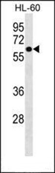ZNF649 antibody