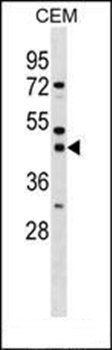 SSBP3 antibody