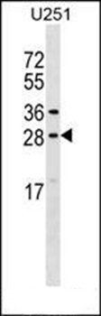 OSTF1 antibody