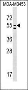 PTDSS1 antibody