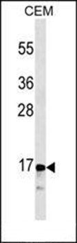 CGRP antibody