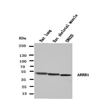 beta Arrestin 1/ARRB1 Antibody