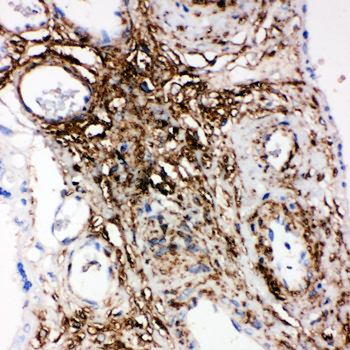 Anti-Phospholipid transfer protein PLTP Antibody