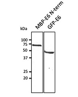 Anti-HPV11 E6