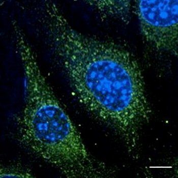 Rab5 antibody