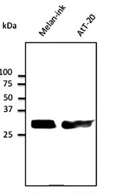 Rab27 antibody