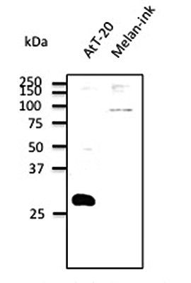 Rab27b antibody