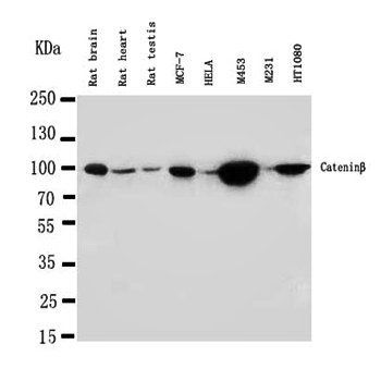 Anti-beta Catenin/CTNNB1 Antibody