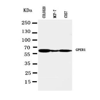Anti-G-protein coupled receptor 30/GPER1 Antibody