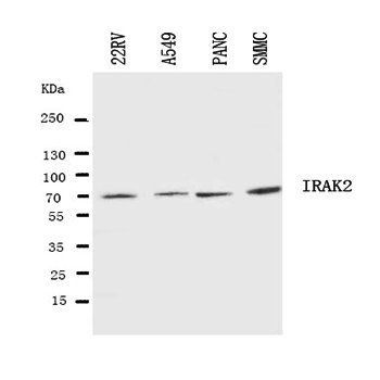 Anti-IRAK2 Antibody