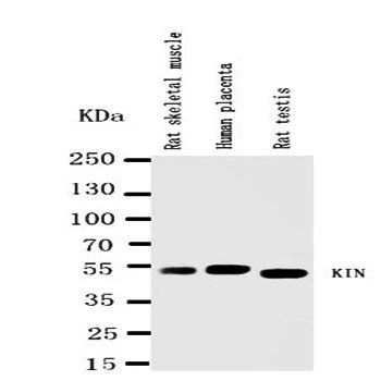 Anti-DNA/RNA-binding protein KIN17 KIN Antibody