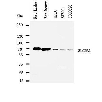 SGLT1/SLC5A1 Antibody