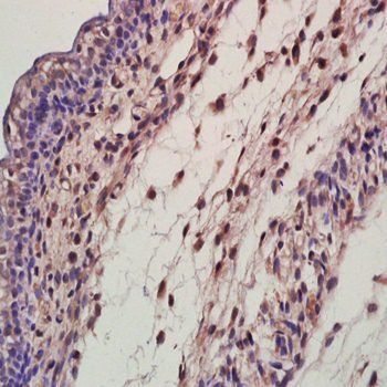 EDA Rabbit Polyclonal Antibody (FITC)