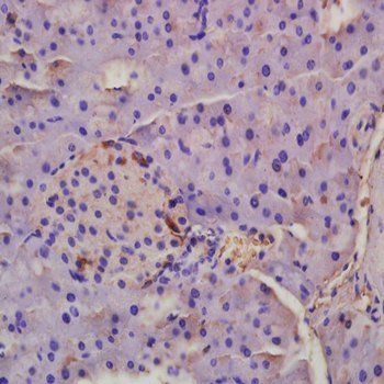 EDA Rabbit Polyclonal Antibody (FITC)