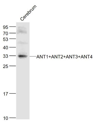 ANT1+ANT2+ANT3+ANT4 antibody