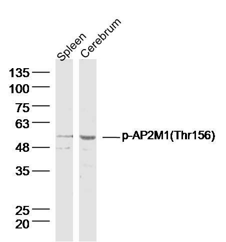 AP2M1 (Phospho-Thr156) antibody