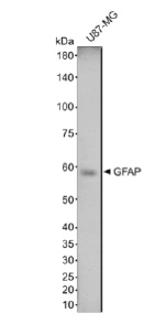 Anti-GFAP VHH antibody