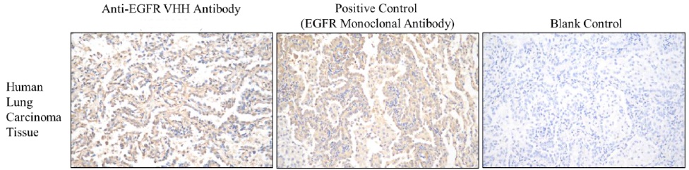 Anti-EGFR VHH antibody