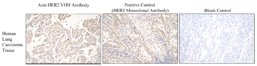 Anti-Her2 VHH antibody