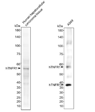 Anti-hTNFR1 VHH antibody