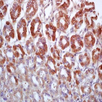 DUOX2 Rabbit Polyclonal Antibody
