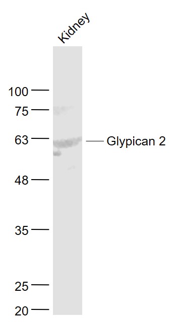 Glypican 2 antibody