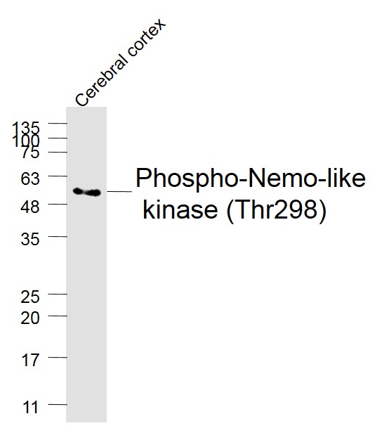 NLK (Phospho-Thr298) antibody
