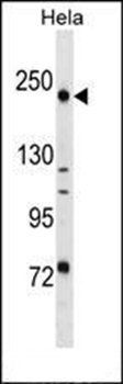 DLEC1 antibody