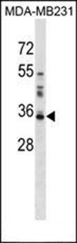 LGALS8 antibody