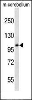 PRMT10 antibody