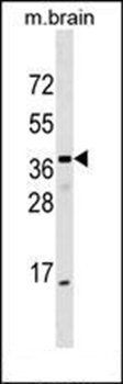ELMOD1 antibody