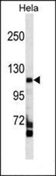 FAM65C antibody