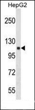 ANKRD18A antibody