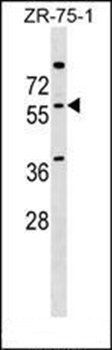 NOVA2 antibody