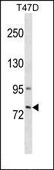 GLB1L3 antibody