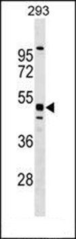 MTL5 antibody