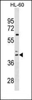 CCR4 antibody