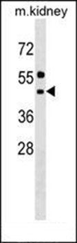 ALG11 antibody