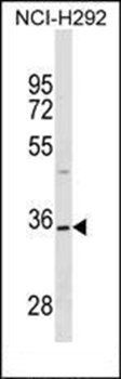 TSPAN18 antibody