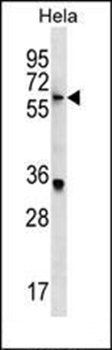 KLH22 antibody