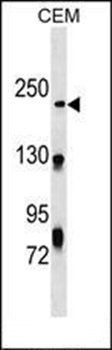 NHSL1 antibody