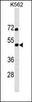 SS18L1 antibody