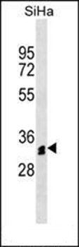 OR51M1 antibody