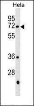 GALNT13 antibody