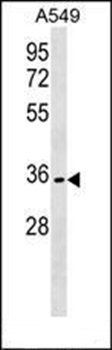 OR51B6 antibody