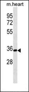 PPP1R3B antibody
