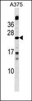 MBD3L1 antibody