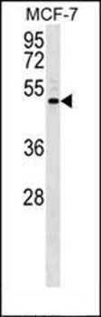 ENPP5 antibody